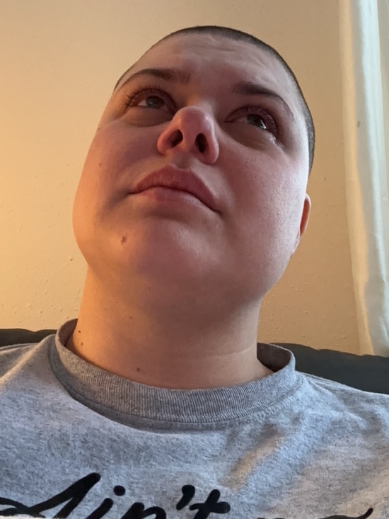 Ashley P. stage 4 DLBCL