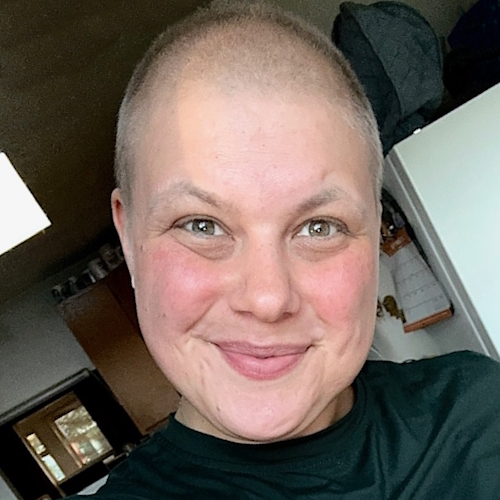 Ashley P. stage 4 DLBCL