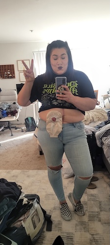 Briana H. stage 3 colorectal cancer