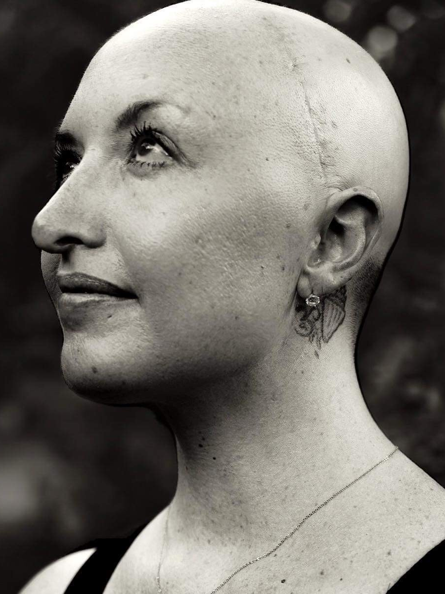 Caroline W. grade 4 glioblastoma