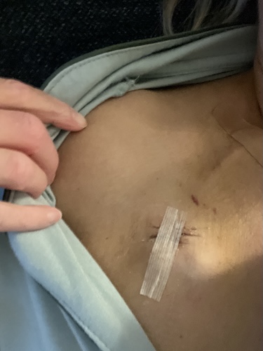 Dawn C. stomach cancer