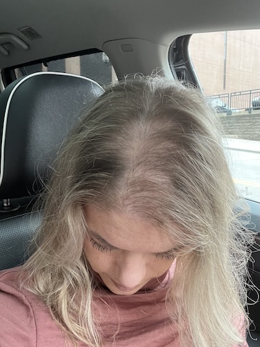 Kailee O. stage 4 colorectal cancer