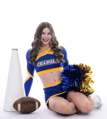 Kelly M. bone sarcoma