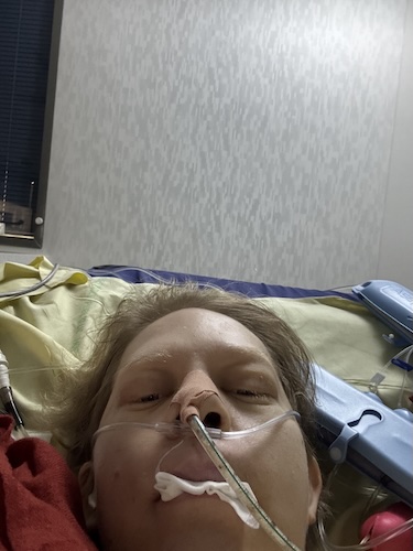 Luwen S. cardia cancer