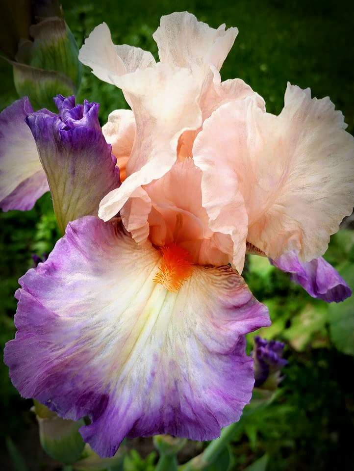 Lynn S. chronic lymphocytic leukemia