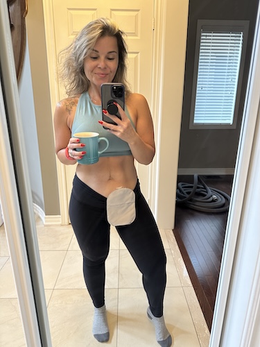 Nadia D. colorectal cancer