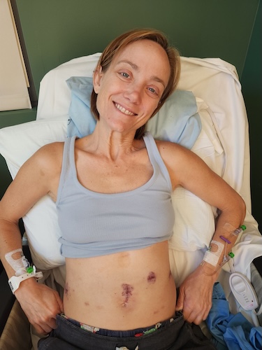 Niccole B. stomach cancer