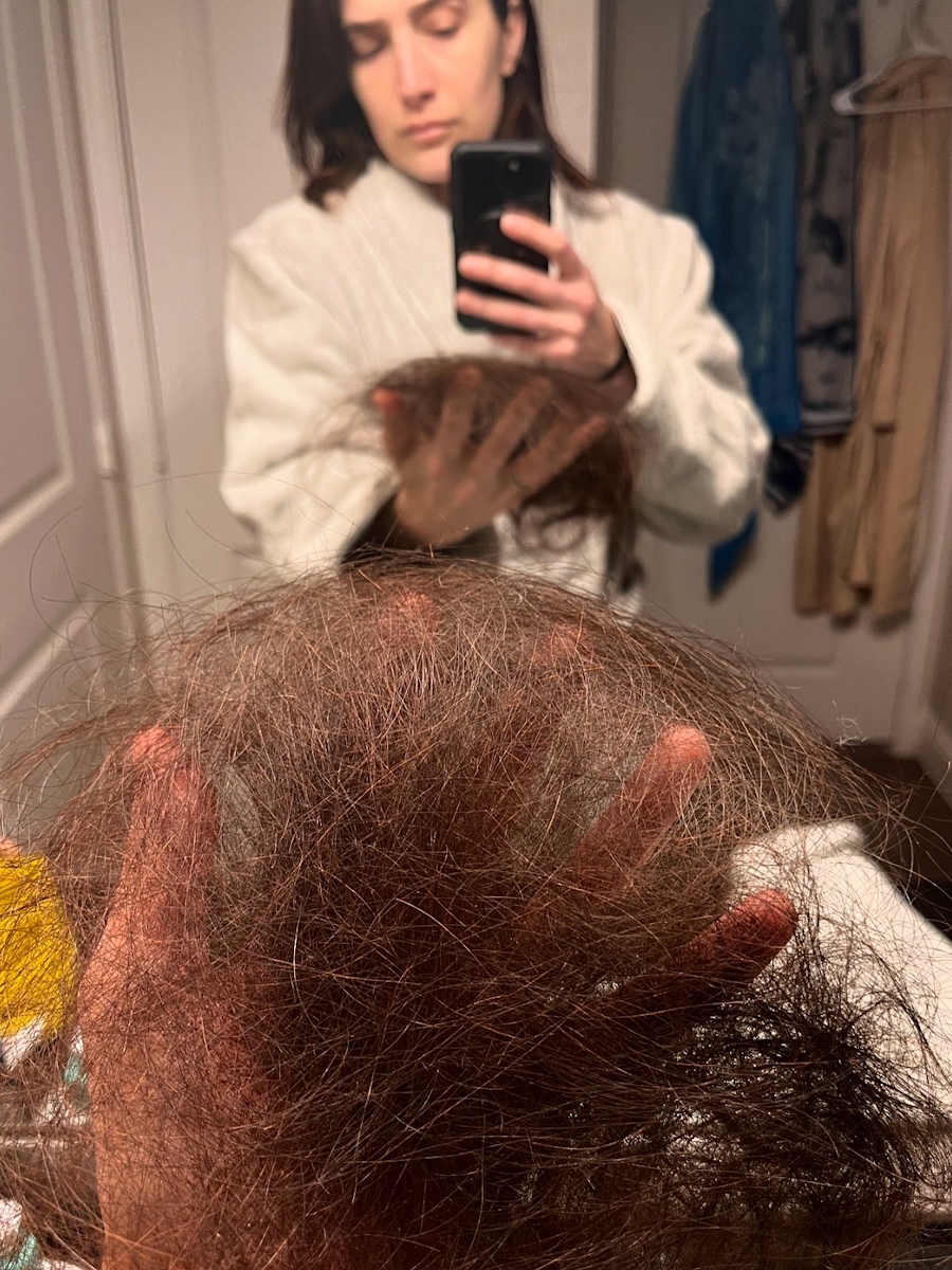 Sorcha B. stage 3 synovial sarcoma