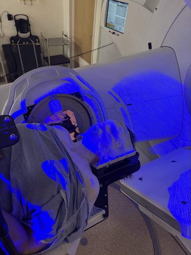 Vikki F. nasal squamous cell carcinoma