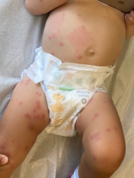 Ali Wolf parent caregiver pediatric cancer