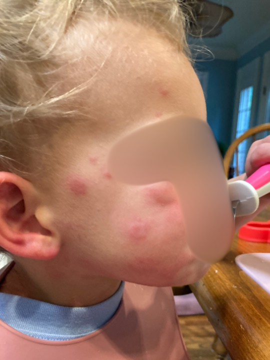 Ali Wolf parent caregiver pediatric cancer