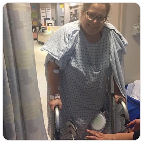 Carly A. vulvar cancer