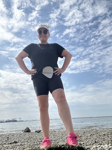 Carly A. vulvar cancer