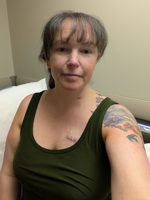 Laura C. stage 4 follicular lymphoma