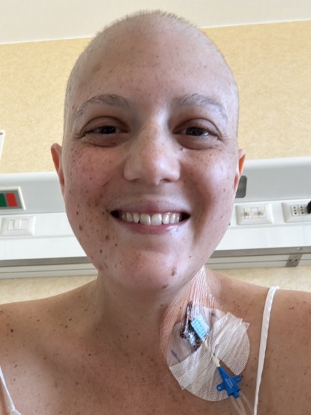 Aleeshia T. stage 4B Burkitt lymphoma