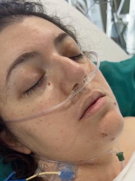 Aleeshia T. stage 4B Burkitt lymphoma