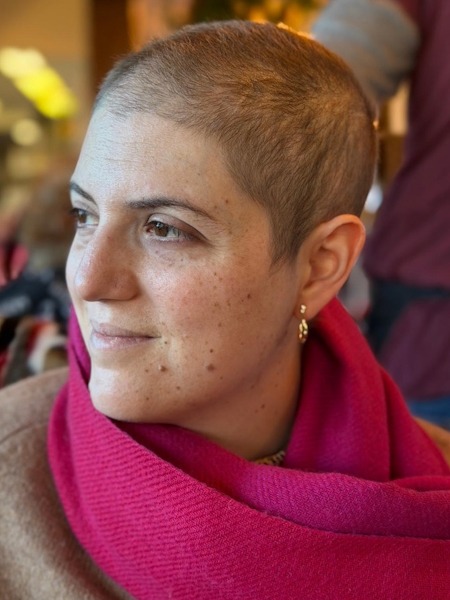 Aleeshia T. stage 4B Burkitt lymphoma