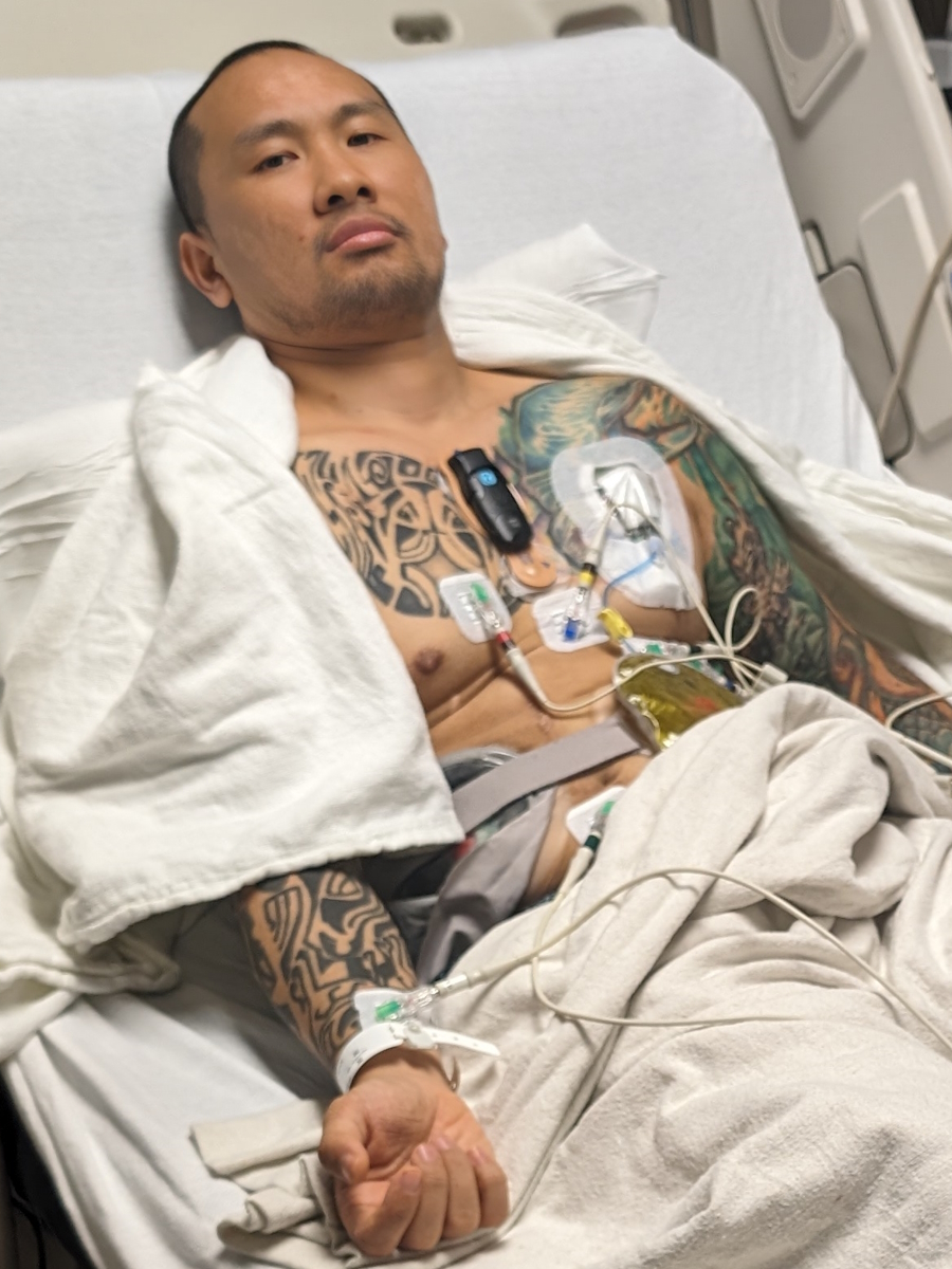 Bill T. rectal neuroendocrine carcinoma