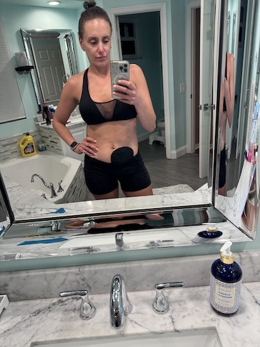 Sarah G. rectal cancer