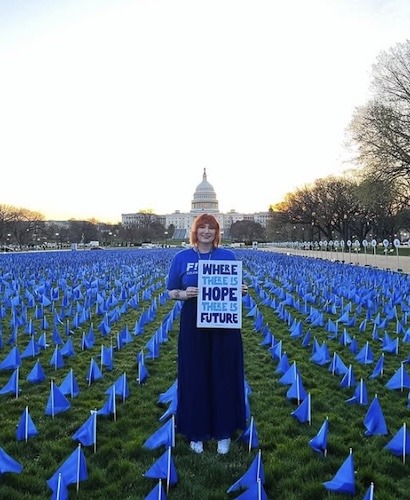 Sydney S. colon cancer