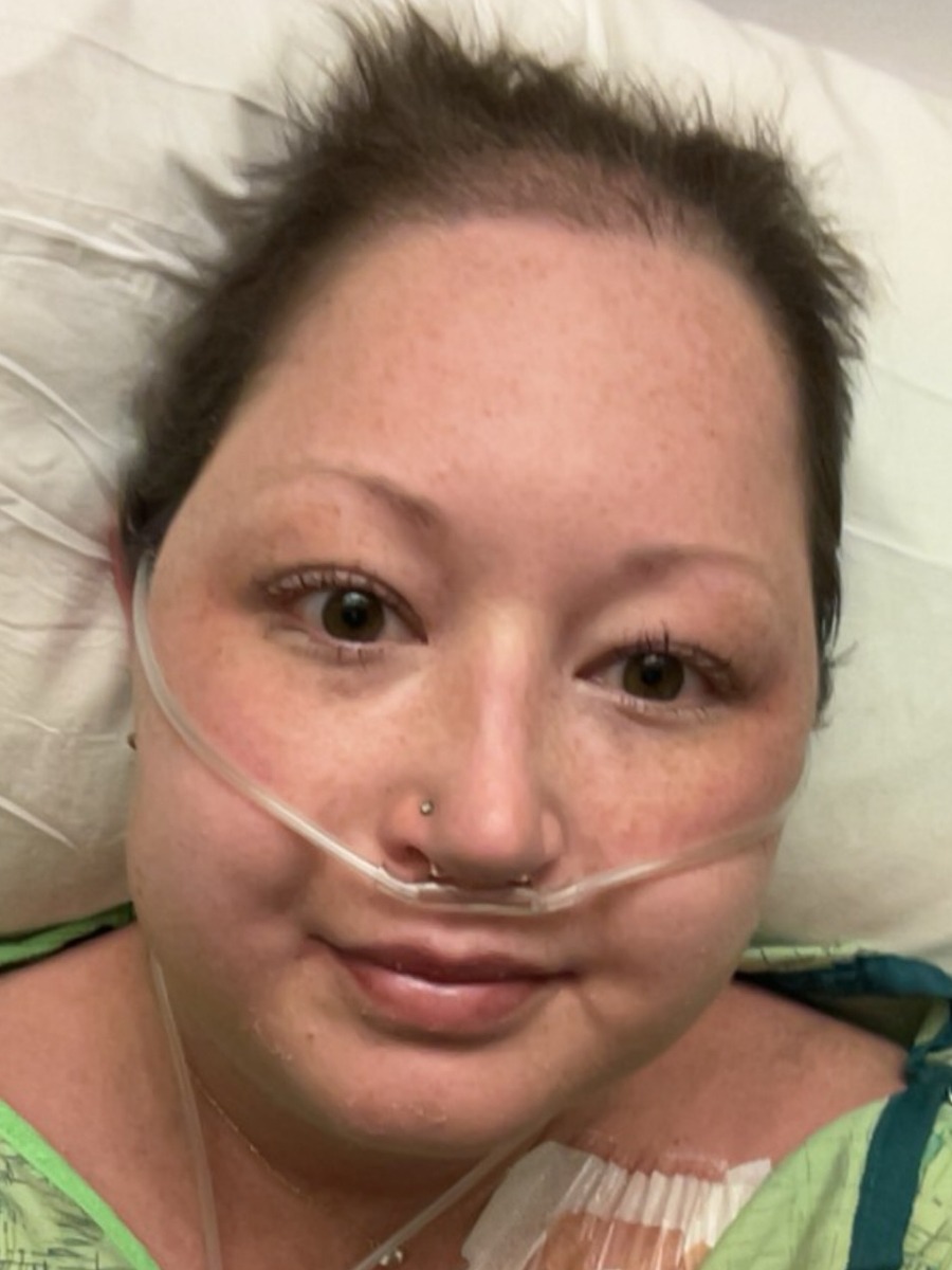 Clara C. stage 4 ALK+ lung cancer