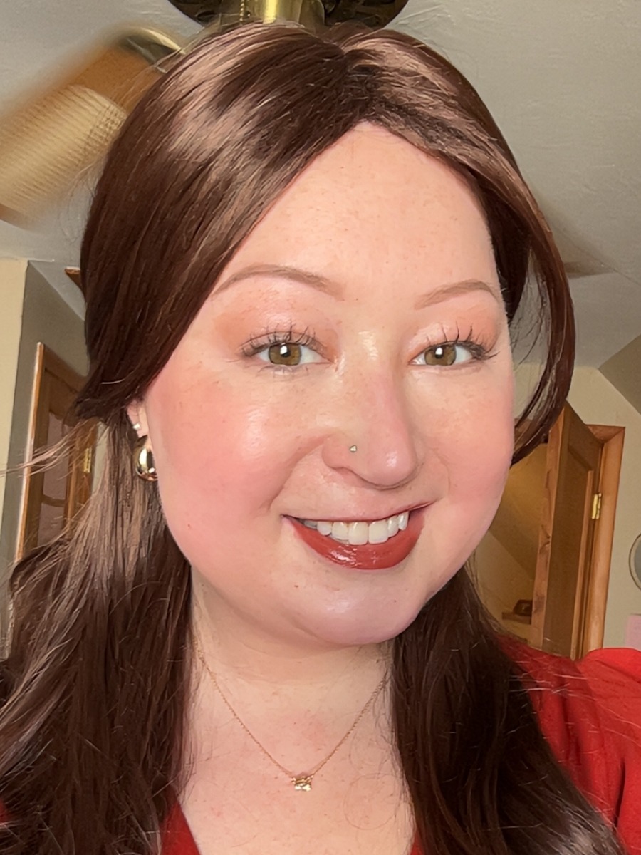 Clara C. stage 4 ALK+ lung cancer