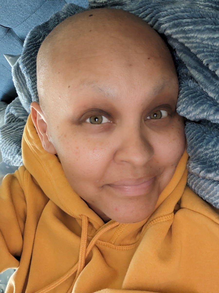 Jes S. triple-negative breast cancer