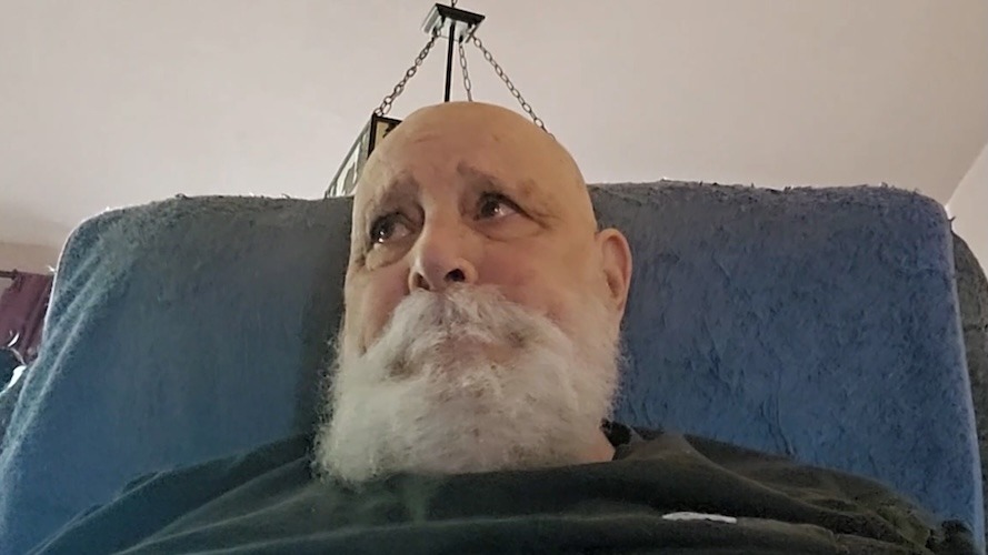 Jim D. prostate cancer