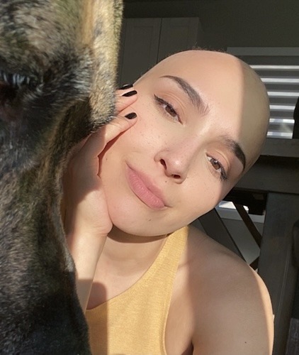 Rebecca W. HER2-positive breast cancer