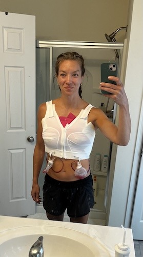 Erica H. metastatic breast cancer