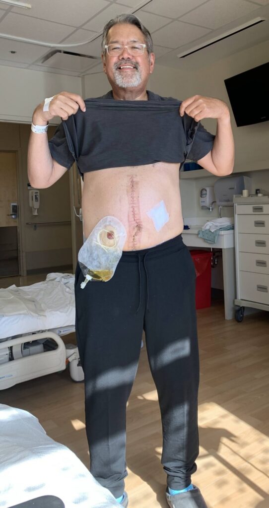 John M. bladder cancer