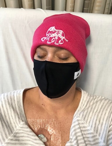 Kristen B. colon cancer
