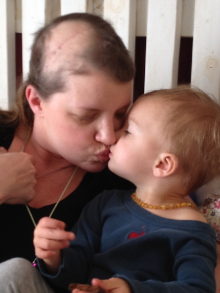 Katie S. grade 4 glioblastoma brain cancer
