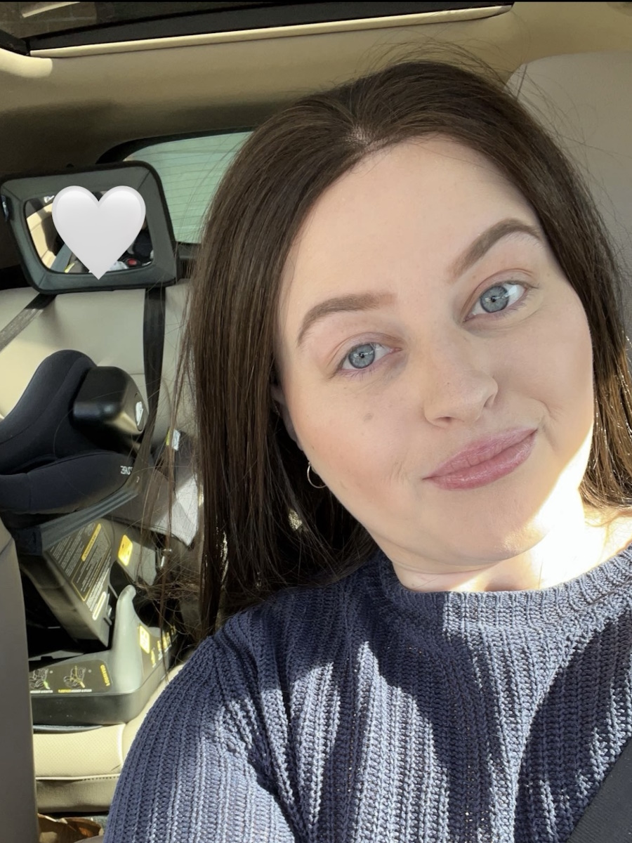 Jessica S. Burkitt lymphoma