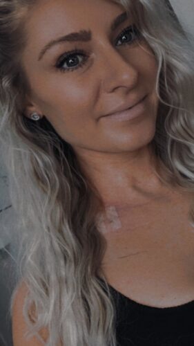 Rachel H. non-Hodgkin lymphoma