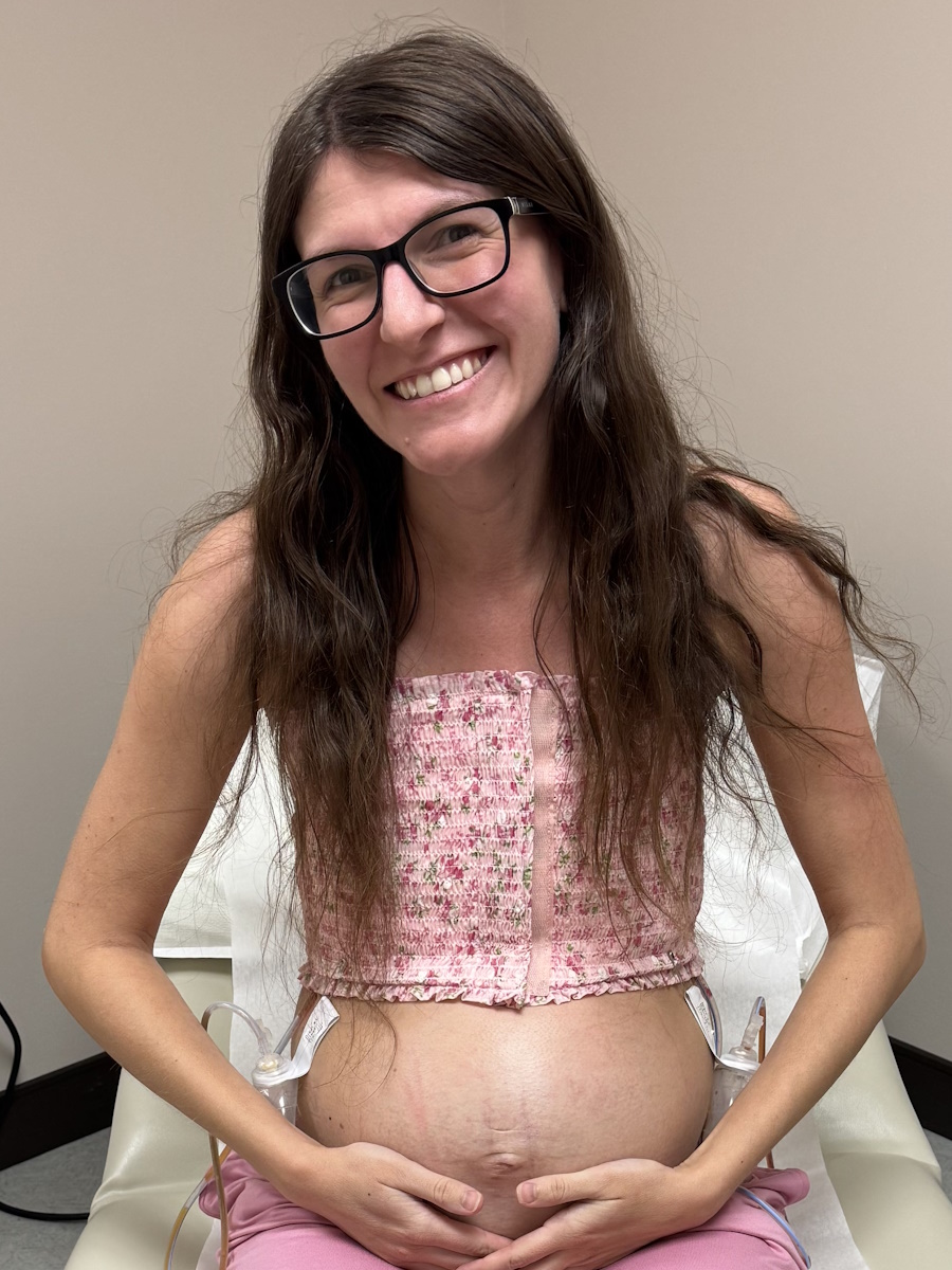 Shelby M. stage 2B breast cancer