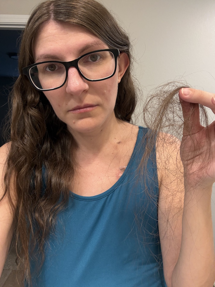 Shelby M. stage 2B breast cancer
