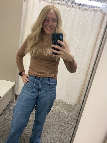 Amanda R. DCIS breast cancer and osteosarcoma