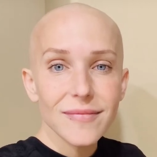 Amanda’s Rare Genetic Condition, Li-Fraumeni Syndrome, Led to Breast Cancer and Osteosarcoma Back to Back