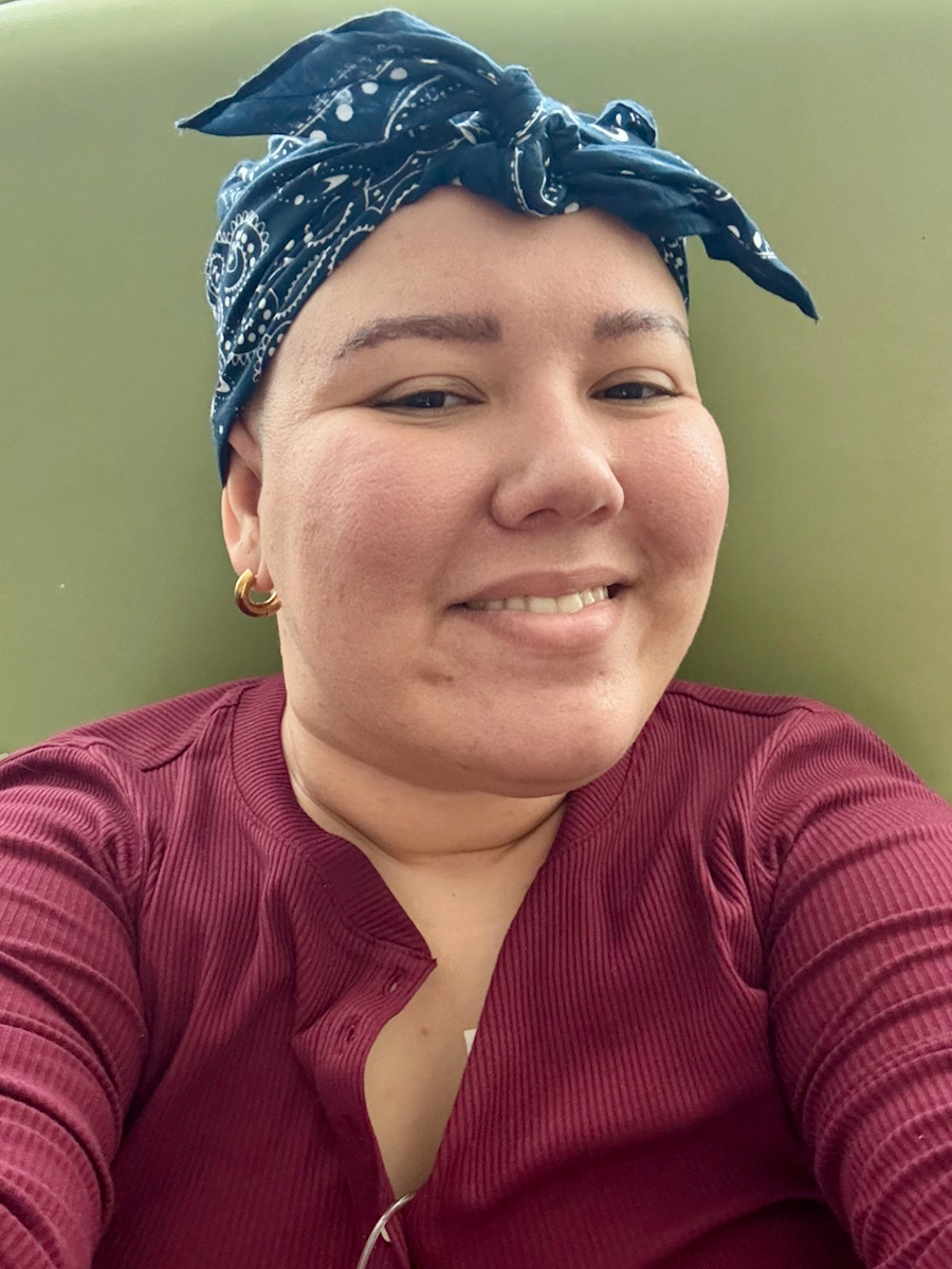 Camila B. non-small cell lung cancer