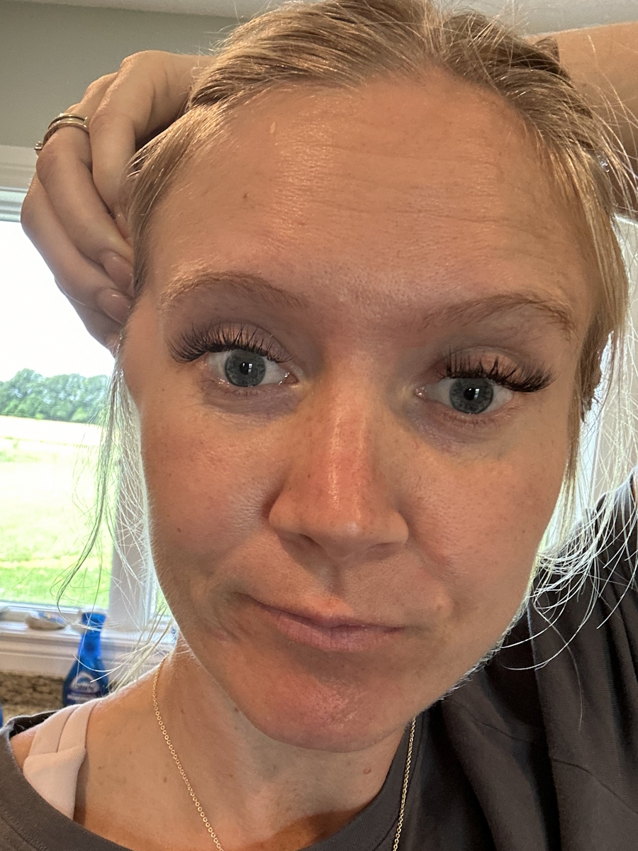 Chelsea S. leiomyosarcoma
