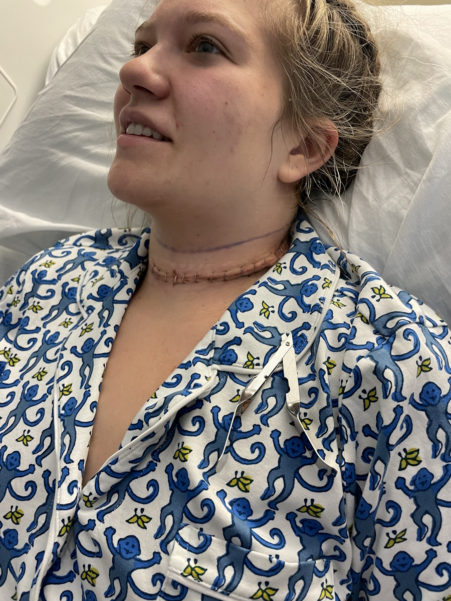 Jess H. papillary thyroid cancer