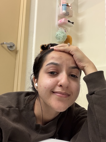 Kat G. myxoid liposarcoma
