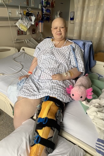 Summer K. osteosarcoma