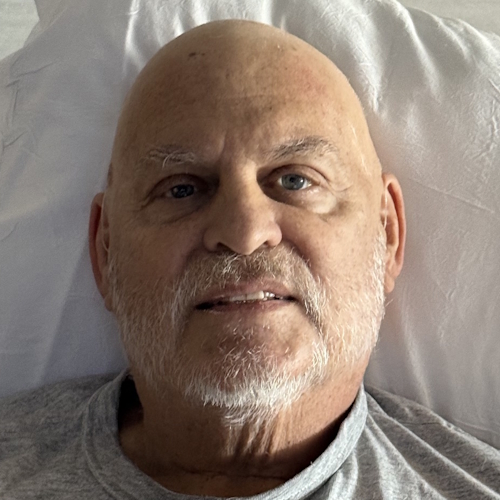 A Rash Only My Wife Worried About Turned Out to Be BPDCN, an Ultra-Rare Blood Cancer