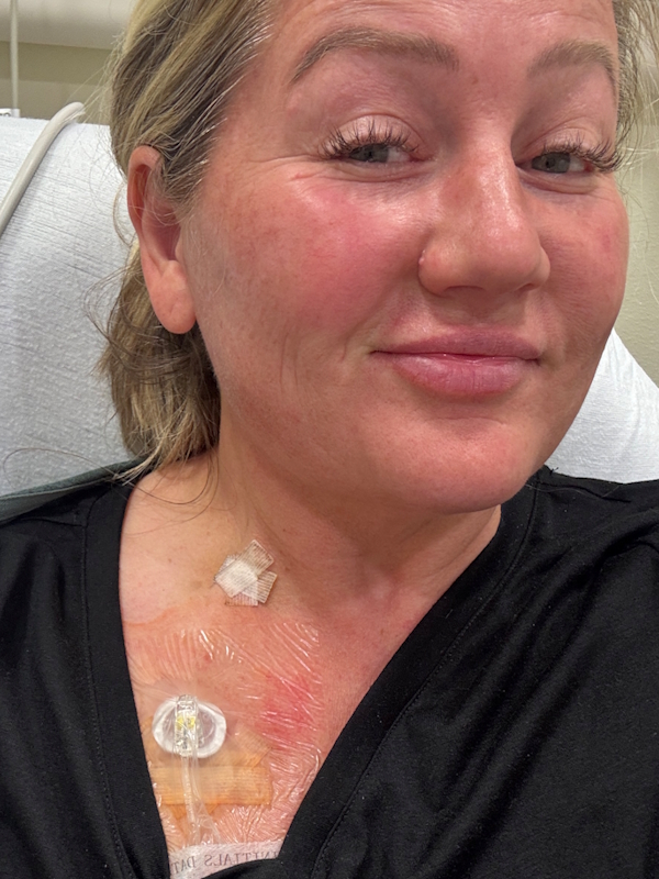 Julee P. leiomyosarcoma