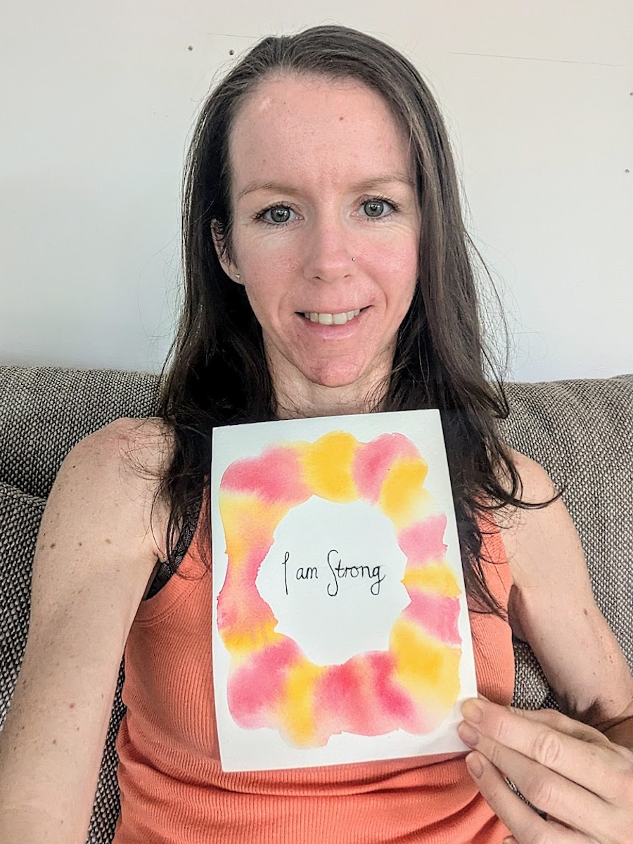 Kirsten R. metastatic melanoma