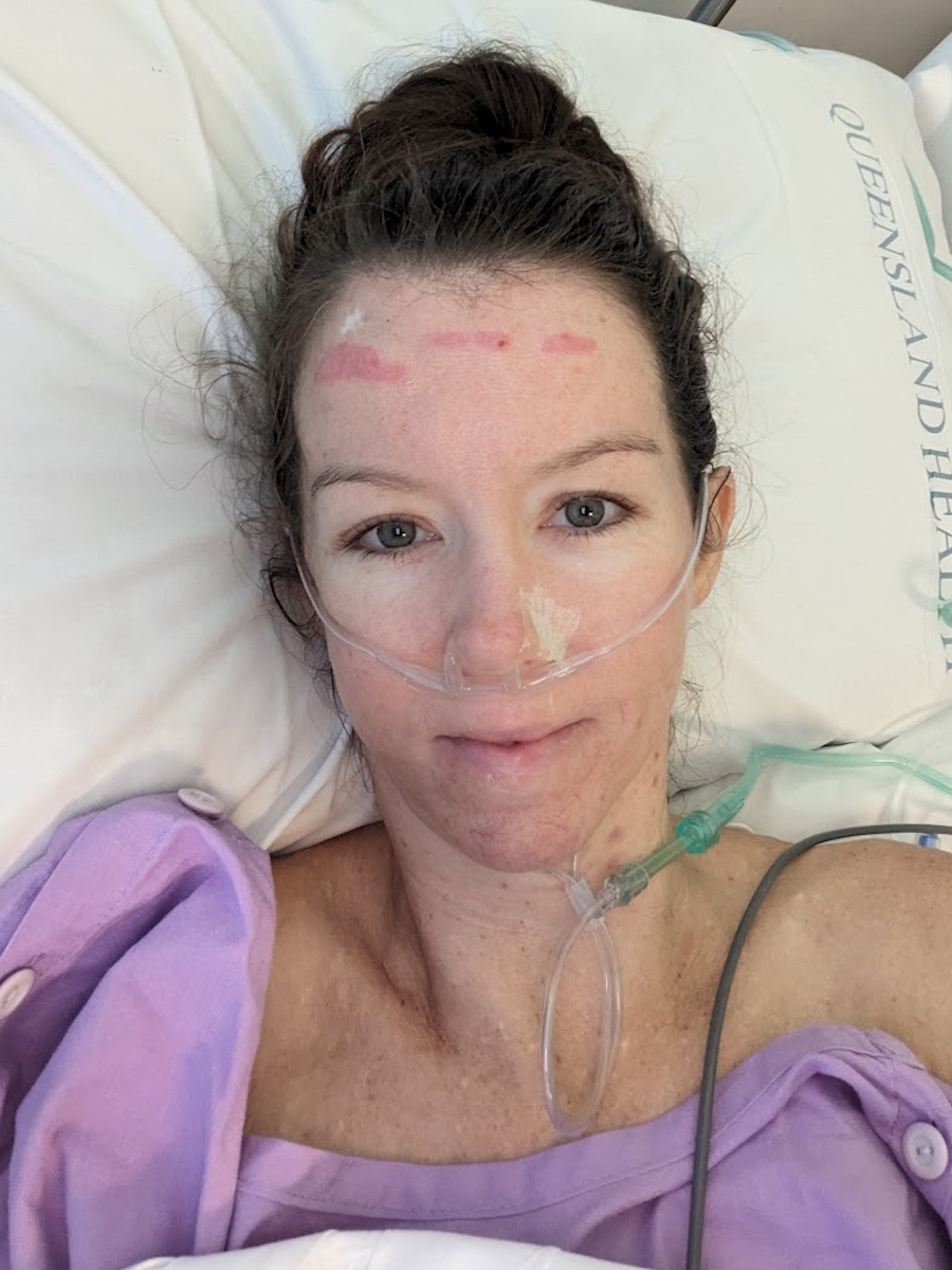 Kirsten R. metastatic melanoma