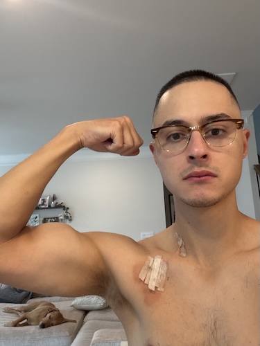 Tyler L. thymic carcinoma