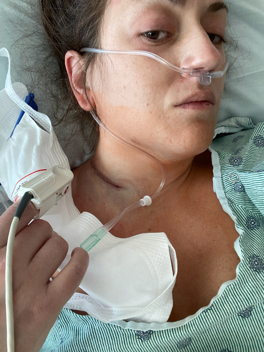 Courtney L. composite lymphoma